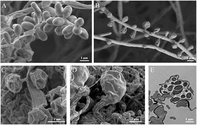 Genome Features and Secondary Metabolites Biosynthetic Potential of the Class Ktedonobacteria